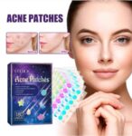 Parche acné 72 pzas