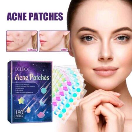Parche acné 72 pzas