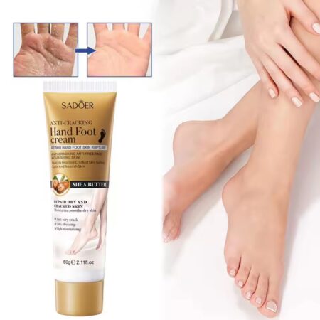 Crema hidratante de manos y pies anti grietas SD89088