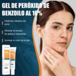 Gel Peroxido Benzoilo 10% anti acné KMC65346